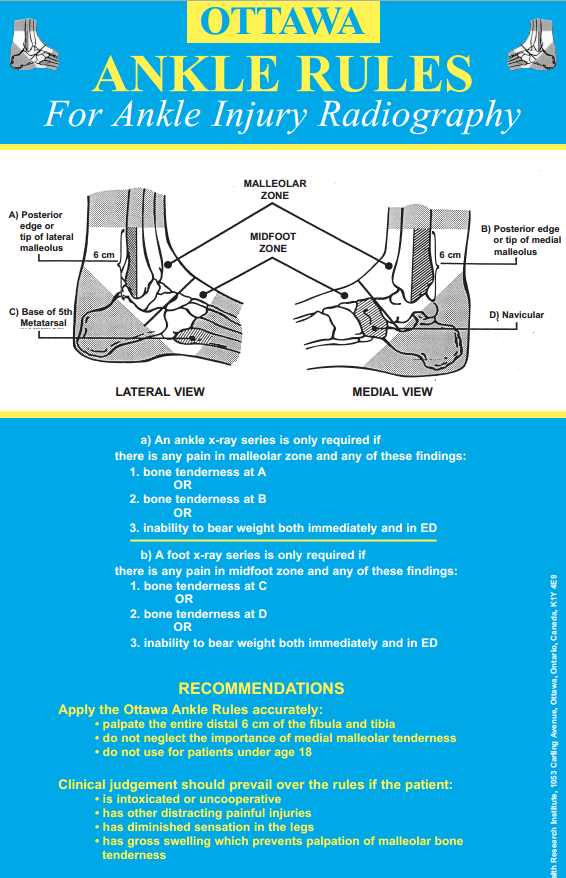 Ottawa ankle and foot. Critical Care Practitioner