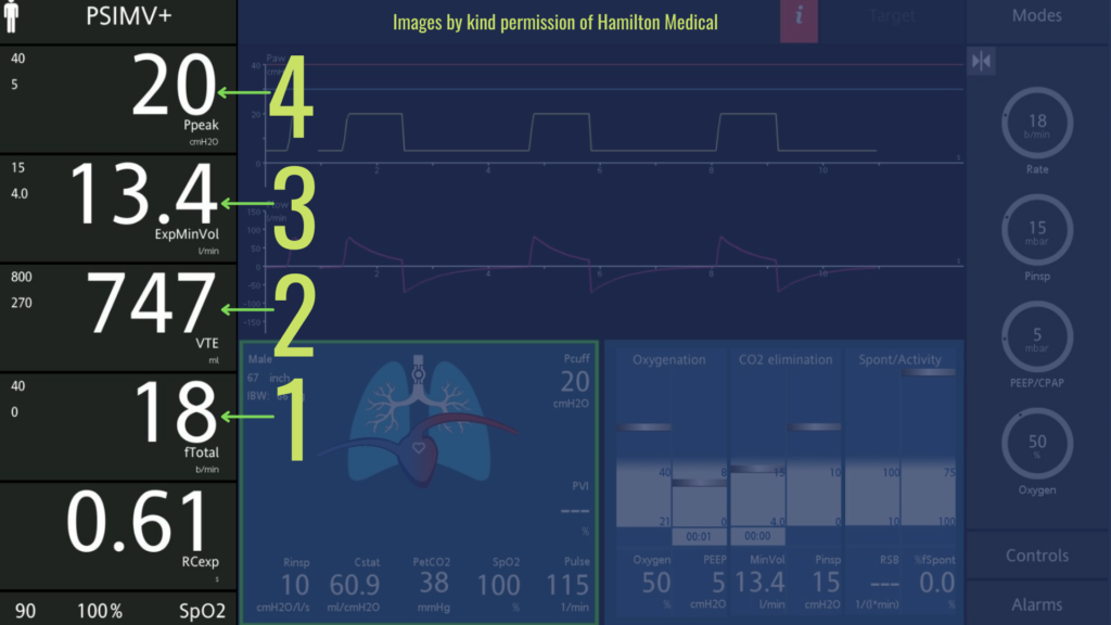 The Ventilator Screen those numbers! Critical Care Practitioner