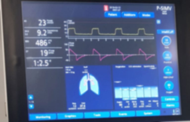 What is Tidal Volume on a Ventilator: Key Facts Explained