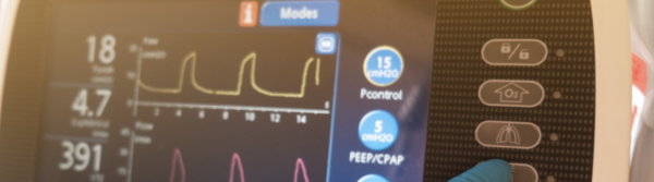 BiPaP- Non Invasive Ventilation